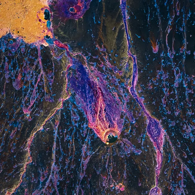 2026 25